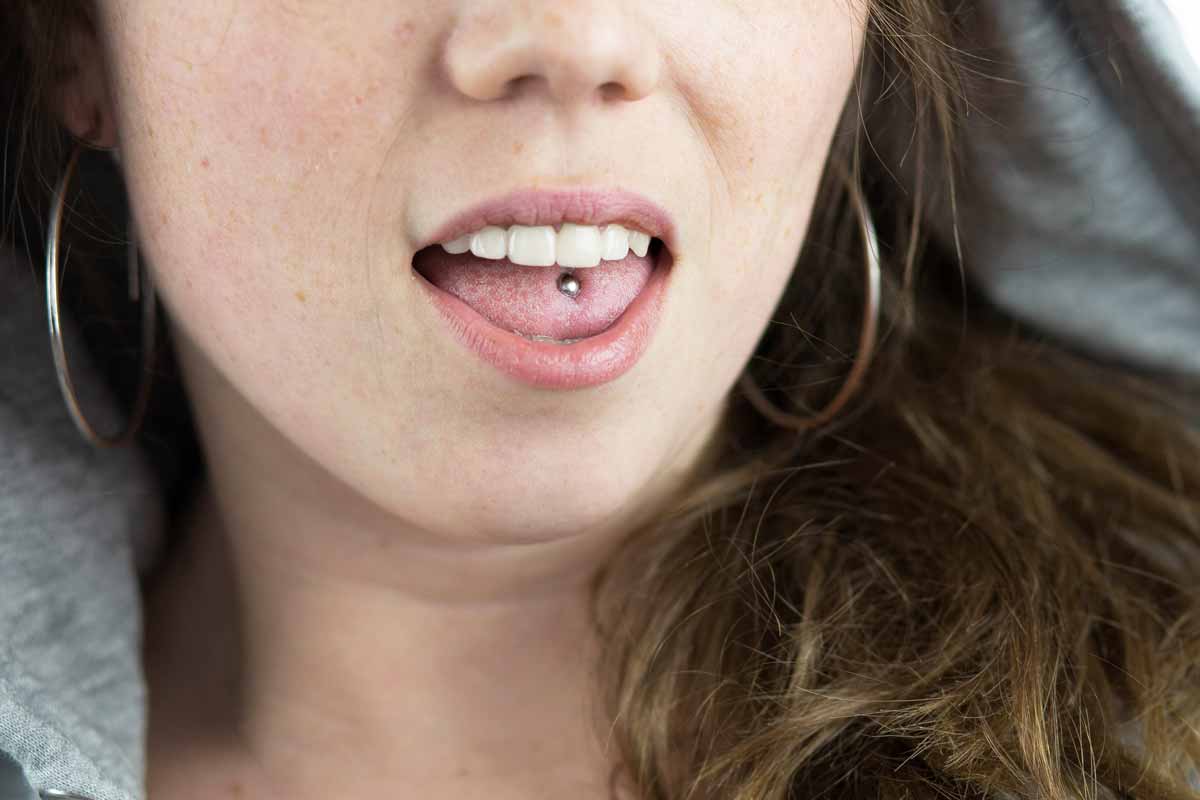 How to Treat Infected Tongue Piercing